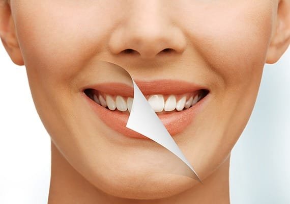 teeth-whitening-team-smile-dentistry-fontham-pelham-general-and-family-dentist Teeth Whitening | Team Smile Dentistry | General & Family Dentist | Fonthill | Ontario