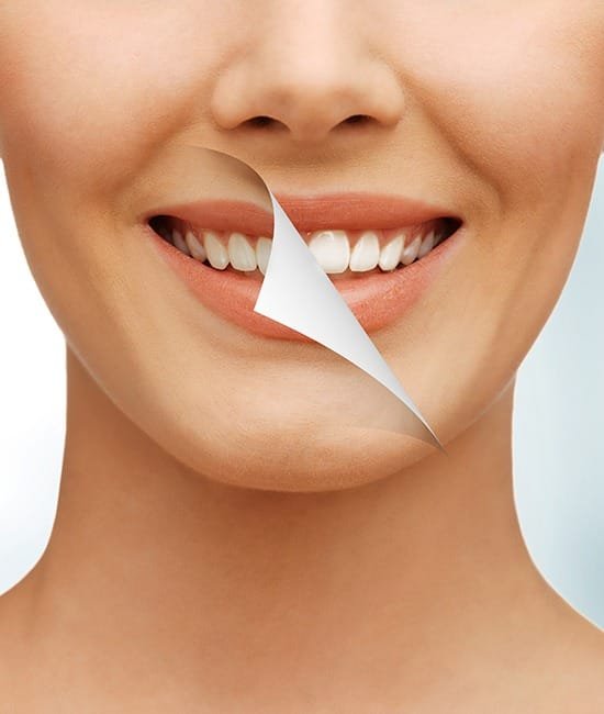 teeth-whitening-team-smile-dentistry-fontham-pelham-general-and-family-dentist